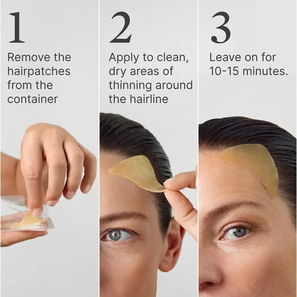 Superpower Thickening Hairpatches - Gold